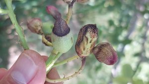 عارضه لکه پوست استخوانی